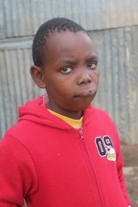 Ten-year old Skhumbuzo Soni will need reconstructive suregery to his lip after he was allegedly struck by a rubber bullet during riots over water in Pietermaritzburg's Willowfontein area. Photo: ANA