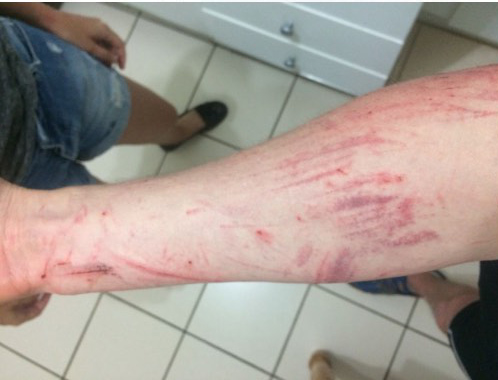 Darryl Colenbrander suffered scratches from jumping into the ravine to escape from the suspect. Picture: Supplied