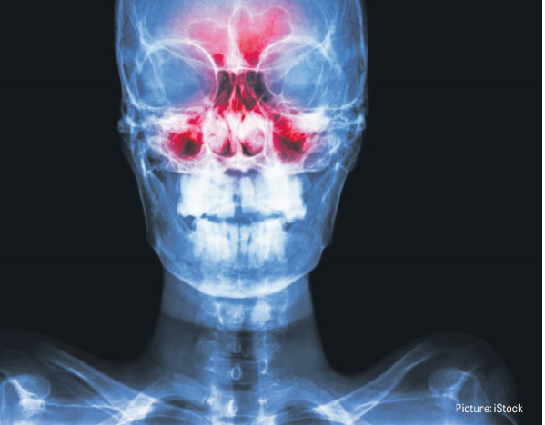 Picture iStock