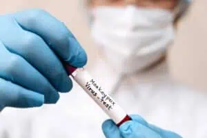 Hammanskraal suspected case tests negative for Mpox